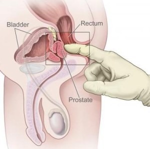 La “Risonanza magnetica” può far evitare  inutili interventi per il cancro alla prostata