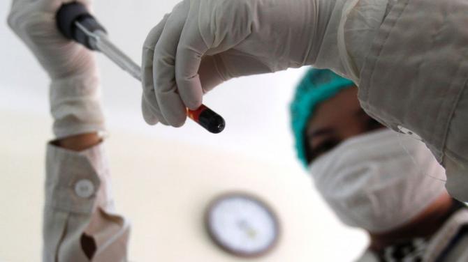 Malato di Aids senza più Hiv dopo trapianto di cellule staminali